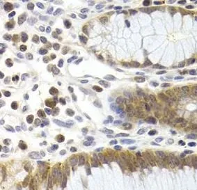 CDK6 antibody - image 1