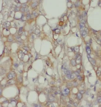CHPF C-Terminal antibody - image 1