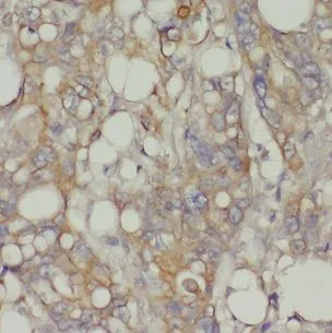 CHRNB1 antibody - image 1
