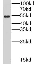 CHRNB1 antibody - image 2