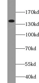 Collagen Type III(N-Terminal) antibody - image 2