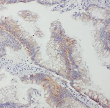 GJB2 antibody - image 1