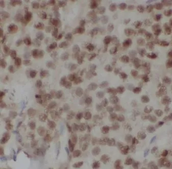 CSE1L antibody - image 1