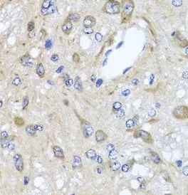 CXCR4 antibody - image 1