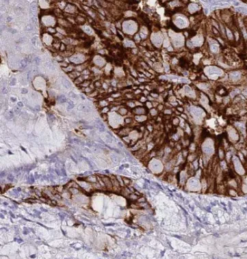 KRT17-Specific antibody - image 1