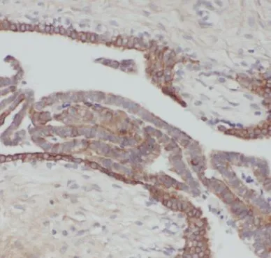 KRT18 antibody - image 1