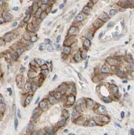 KRT18 antibody - image 1