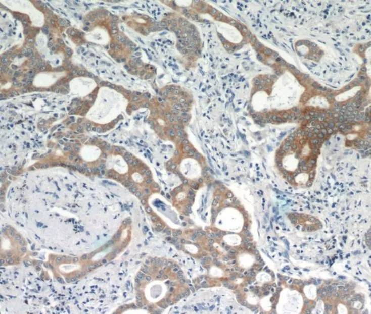 KRT18 antibody - image 1