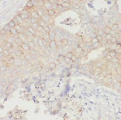 KRT8 antibody - image 1