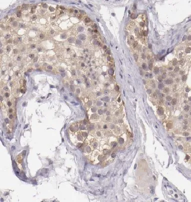 DDR1 antibody - image 1