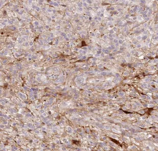 DKK1 antibody - image 1