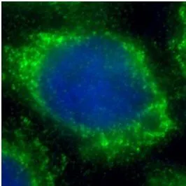 DKK1 antibody - image 2