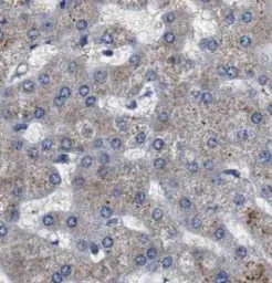 DSE antibody - image 1