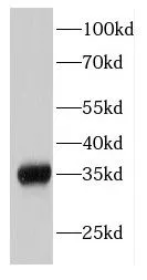 EIF2S1 antibody - image 2