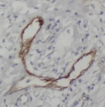 ENG antibody - image 1