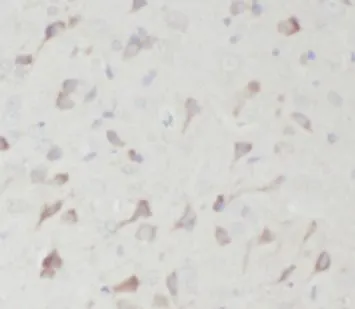 ENO1 antibody - image 1
