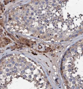 EXD1 antibody - image 1