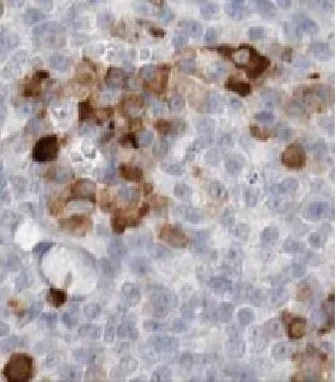 FSCN1 antibody - image 1