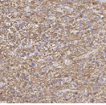 FBXO6 antibody - image 1