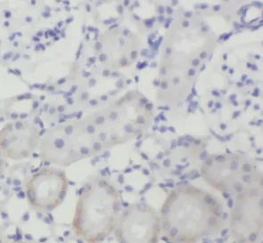 FZD10 antibody - image 1