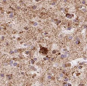 GALC antibody - image 1