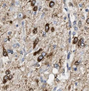 GFAP antibody - image 1