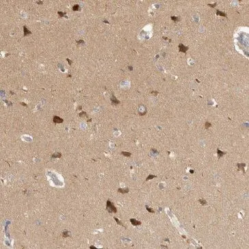 GMFB antibody - image 1