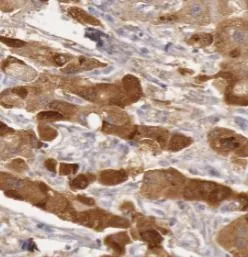 GSTO1 antibody - image 1