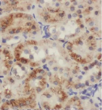 TSC1 antibody - image 1