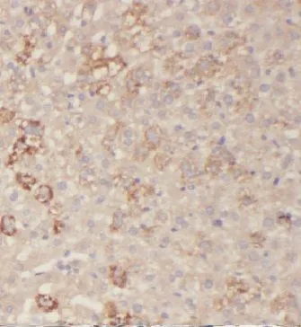 HAS3 antibody - image 1