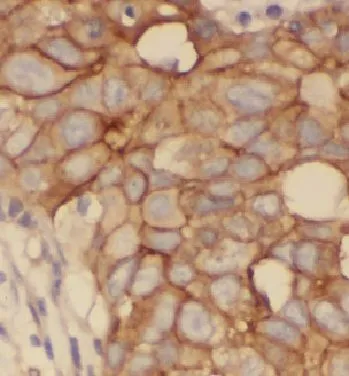 HCCS antibody - image 1