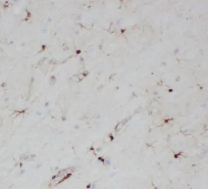 HES5 antibody - image 1