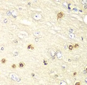 HIF1AN antibody - image 1