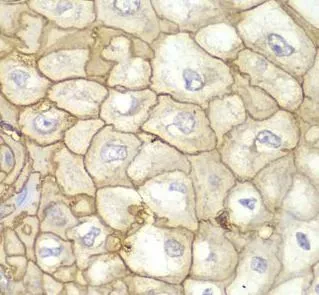 HLA-A antibody - image 1