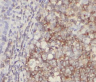 HMMR-Specific antibody - image 1