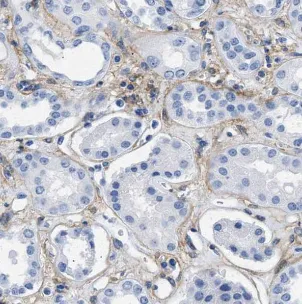 HSD17B11 antibody - image 1