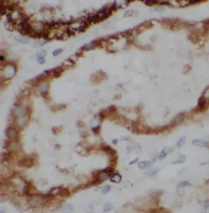 HTRA2 antibody - image 1