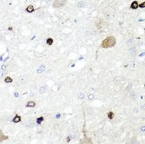 IGFBP5 antibody - image 1