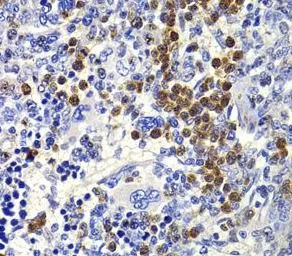 IL21 antibody - image 1