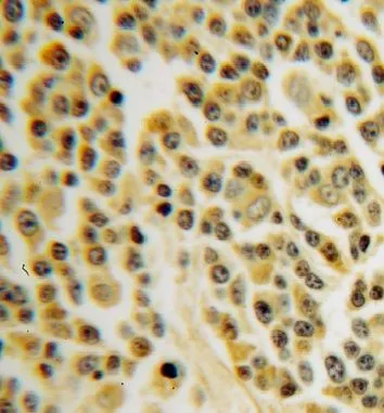 INPP5B antibody - image 1