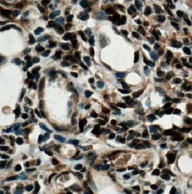 IRF4 antibody - image 1