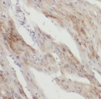 KANK1 antibody - image 1