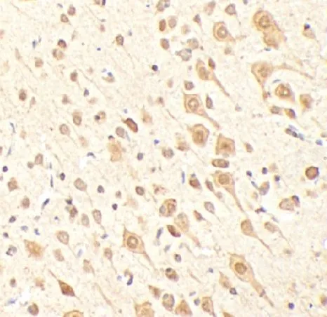KDM2A antibody - image 1