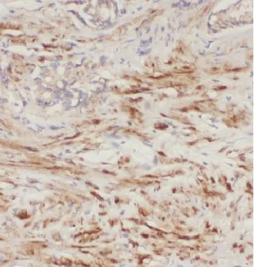KLK3 antibody - image 1