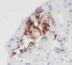 ITPRID2 antibody - image 1