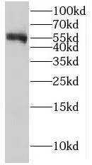 LCAT antibody - image 1