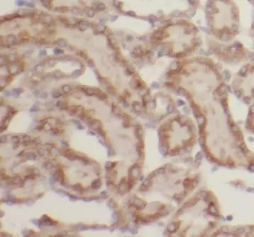 LHPP antibody - image 1