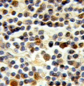 STK11 antibody - image 1