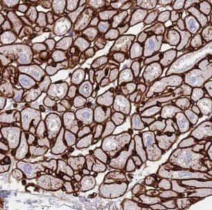 LNPEP antibody - image 1