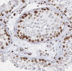 LRRTM1 antibody - image 1